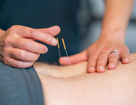 We provide acupuncture for our cancer patients